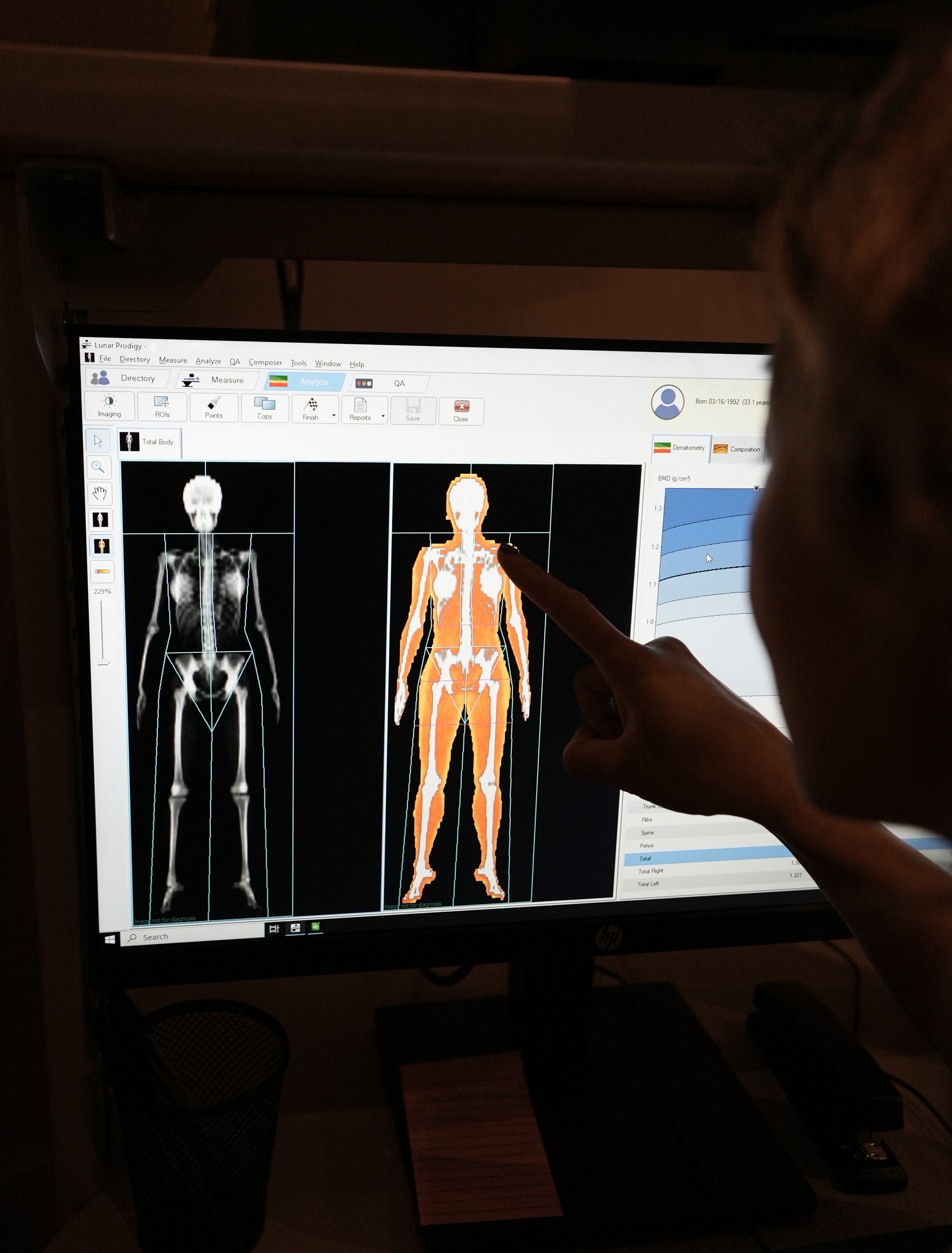 DEXA Scan