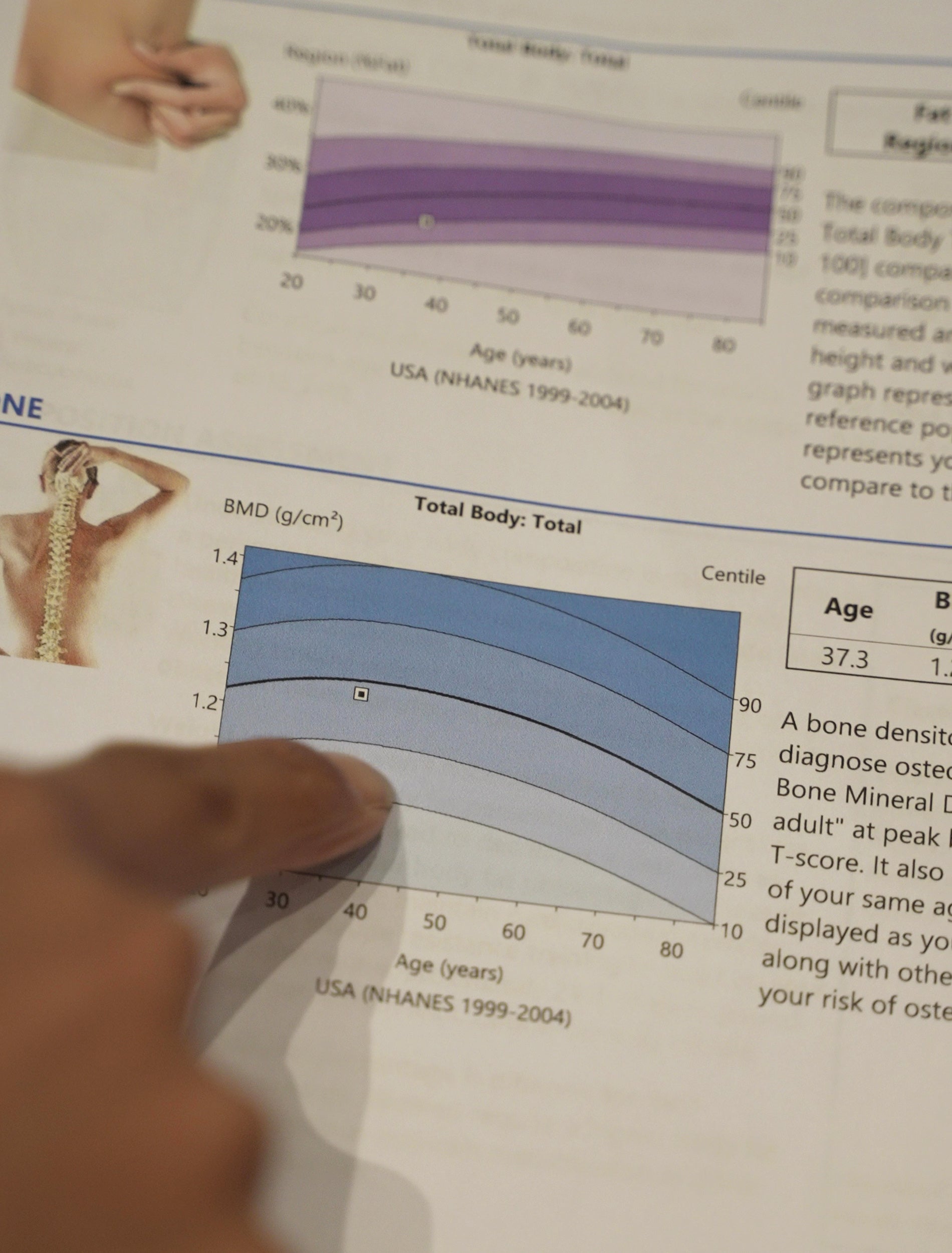 Vancouver DEXA Scan – Regen Recovery